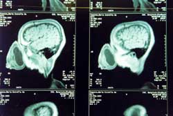 Copyright: Ute Glaser